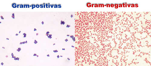Bactérias gram-positivas e gram-negativas. Fotos: Y_tambe / Wikimedia Commons ([1][2]) [CC-BY-SA 3.0]
